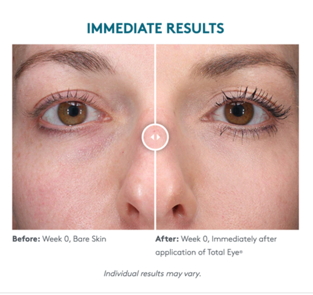 Total Eye® 3-in-1 Renewal Therapy SPF 35