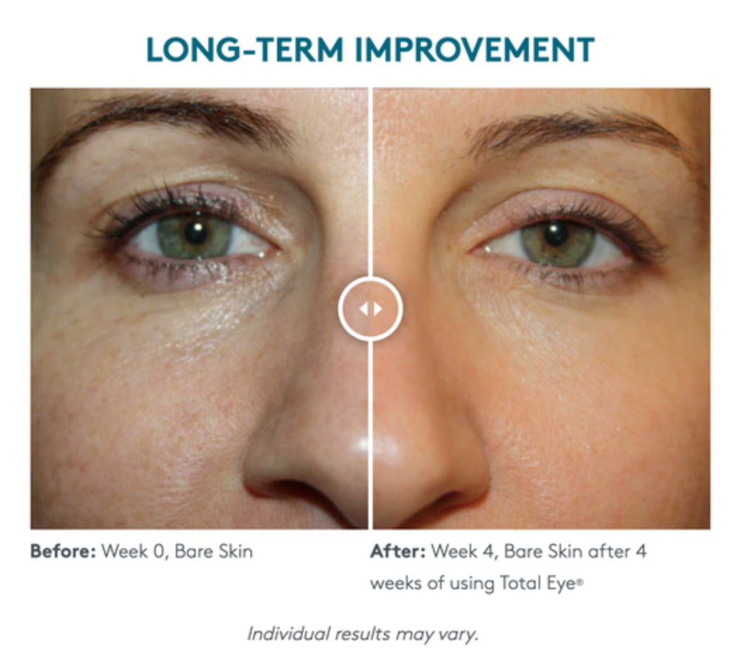 Total Eye® 3-in-1 Renewal Therapy SPF 35