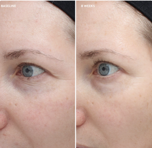 Total Eye® Firm & Repair Cream