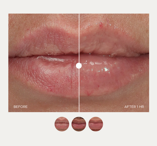 ÂN-GLOSS Ceramide Lip Treatment