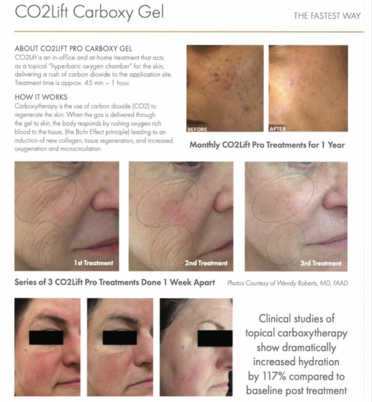 CO2 Lift Pro Carboxy Gel Treatment