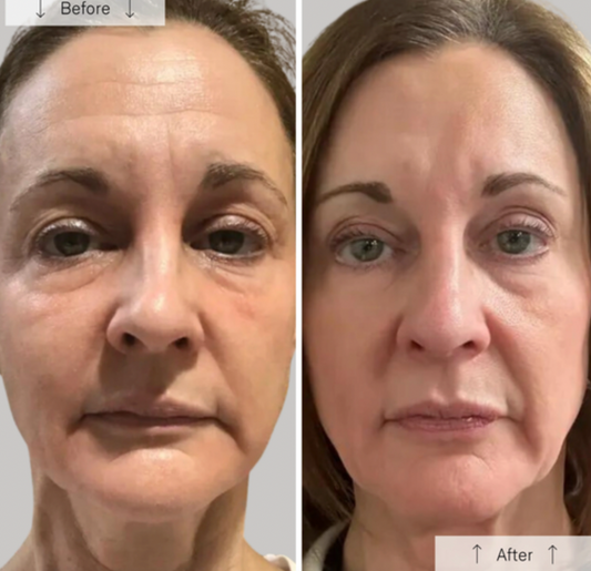 Omnilux Contour Face