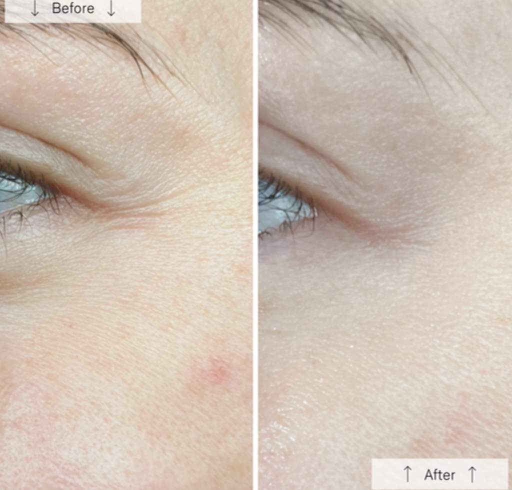 Omnilux Contour Face