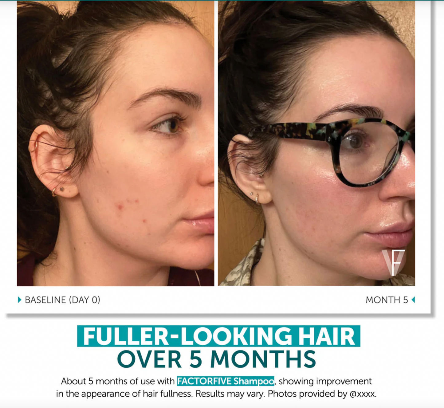 FACTORFIVE Shampoo Advanced Haircare