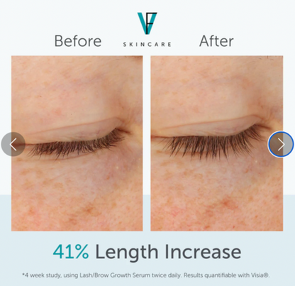 Lash/Brow Growth Serum