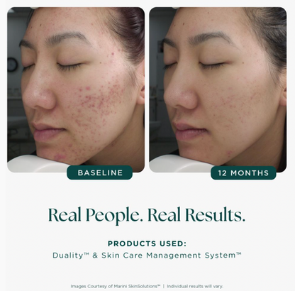 Age Intervention® Duality™