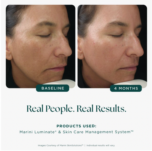 Marini Luminate® Face Lotion