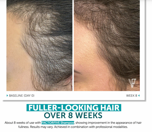 FACTORFIVE Shampoo Advanced Haircare