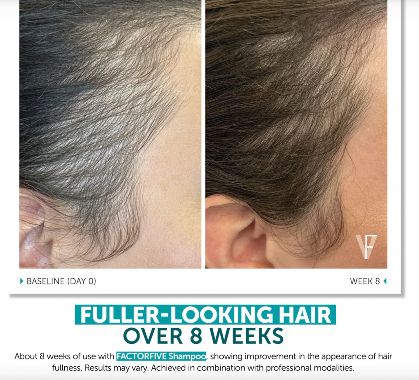 FACTORFIVE Shampoo Advanced Haircare