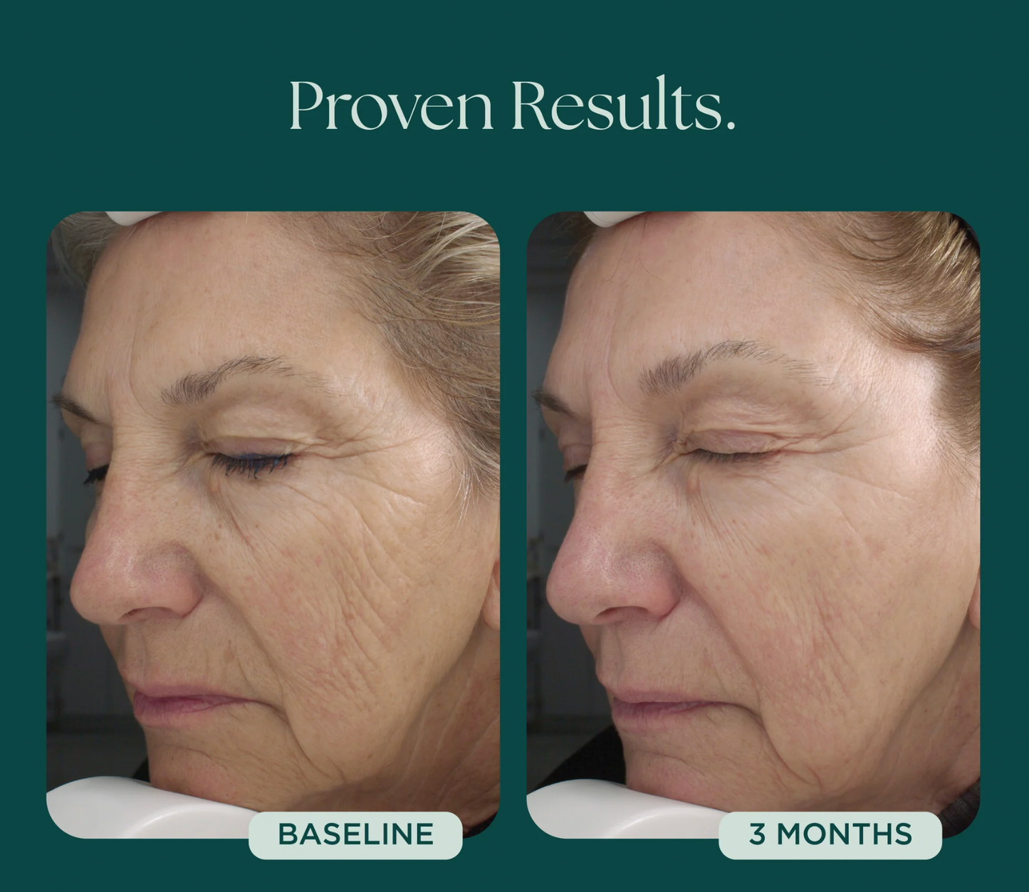 Retinol Plus (Age Intervention®)