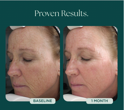 Retinol Plus (Age Intervention®)